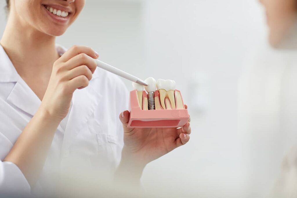 find the best dental implant dentist in area blog