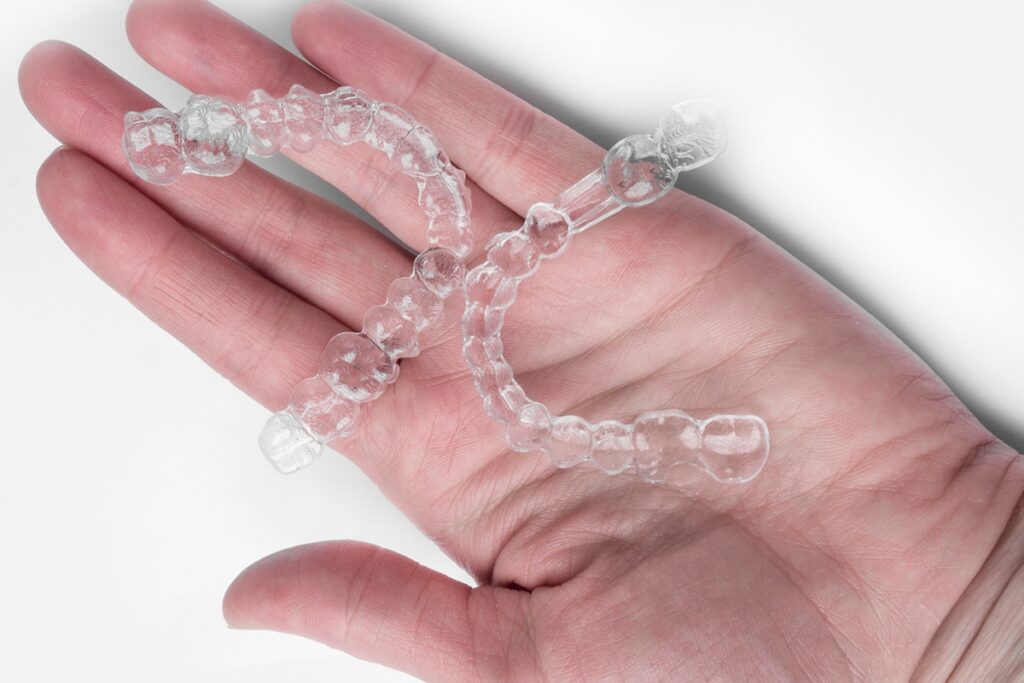 how does invisalign work blog