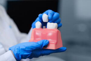Restorative Dentistry Lakeside FL